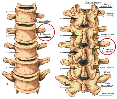 l2 + left|left l2 transverse process fracture.